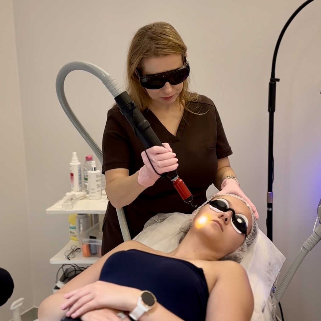 Zabieg laserowy na twarz, laser pikosekundowy, usuwanie przebarwień